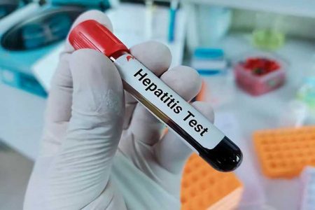 برنامه وزارت بهداشت برای حذف «هپاتیت C»/ برآورد ابتلای 200 هزار ایرانی