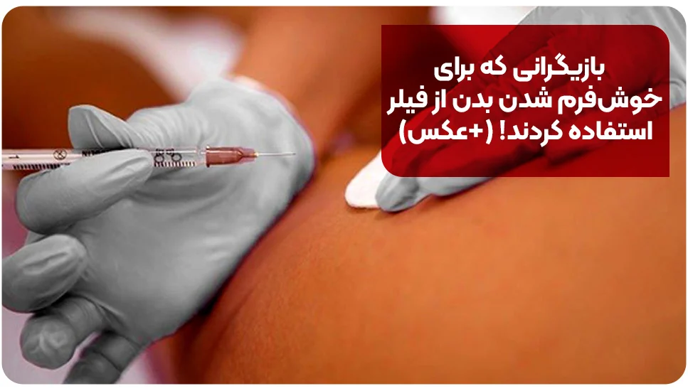 بازیگرانی که برای خوش‌فرم شدن بدن از فیلر استفاده کردند! (+عکس)