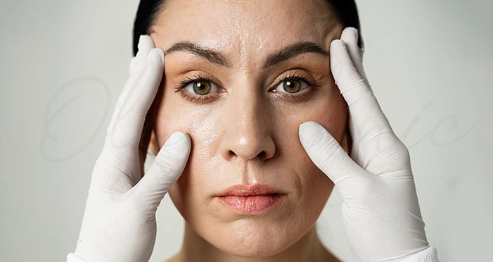 فیلر زیر چشم