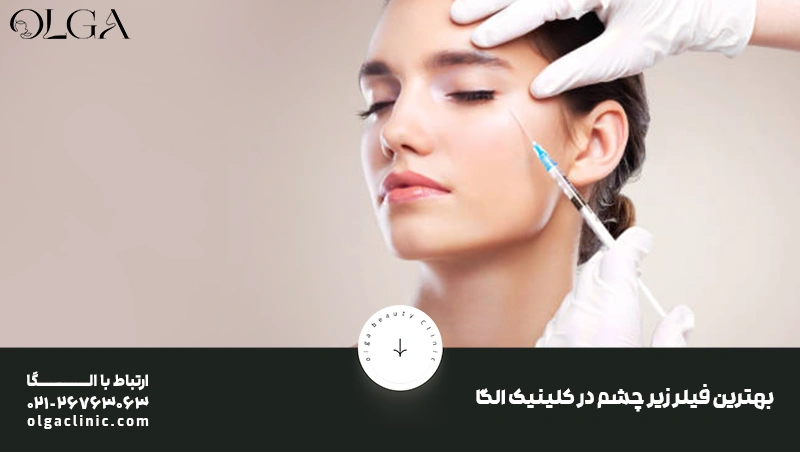 بهترین فیلر زیر چشم در کلینیک الگا