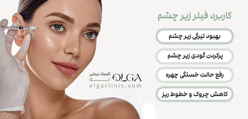 کاربرد فیلر زیر چشم